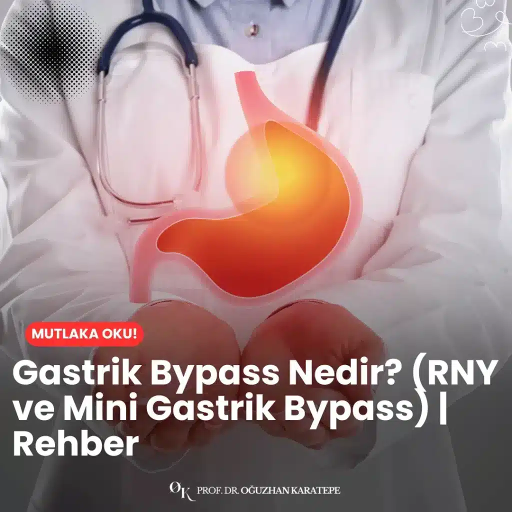 Gastrik bypass nedir? (RNY ve mini gastrik bypass) | rehber içeriğinde bu iki cerrahi yöntemin farklarını, nasıl uygulandığını ve kimler için uygun olduğunu ayrıntılı şekilde bulabilirsiniz.
