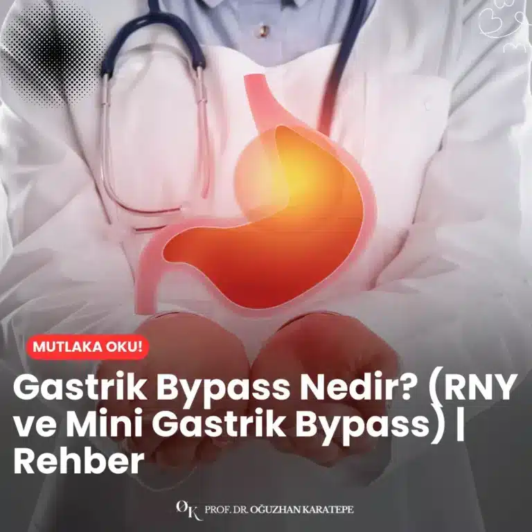 Gastrik bypass nedir? (RNY ve mini gastrik bypass) | rehber içeriğinde bu iki cerrahi yöntemin farklarını, nasıl uygulandığını ve kimler için uygun olduğunu ayrıntılı şekilde bulabilirsiniz.