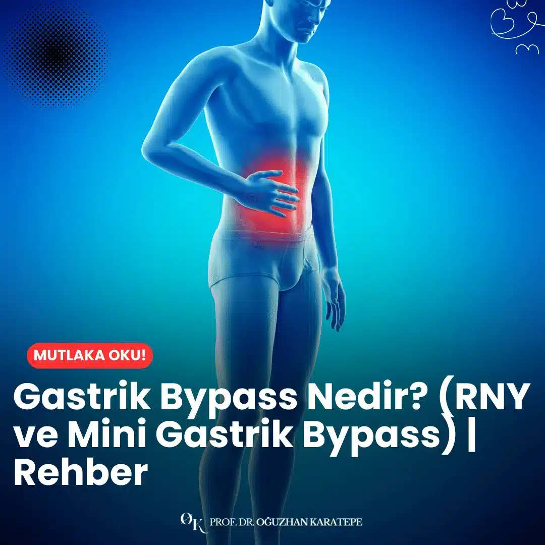 Gastrik bypass nedir? (RNY ve mini gastrik bypass) | rehber başlığında, ameliyat teknikleri, avantajları, olası riskler ve iyileşme süreci gibi tüm detayları güncel bilgilerle ele alıyoruz.