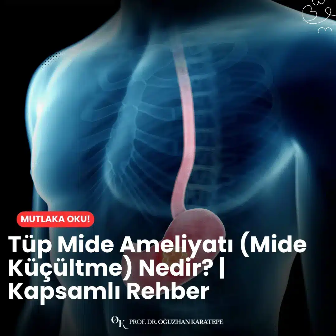 Tüp mide ameliyatı (mide küçültme) nedir? | kapsamlı rehber sayesinde bu cerrahinin nasıl yapıldığını, kimlere uygulandığını, avantajlarını ve risklerini adım adım öğrenin.