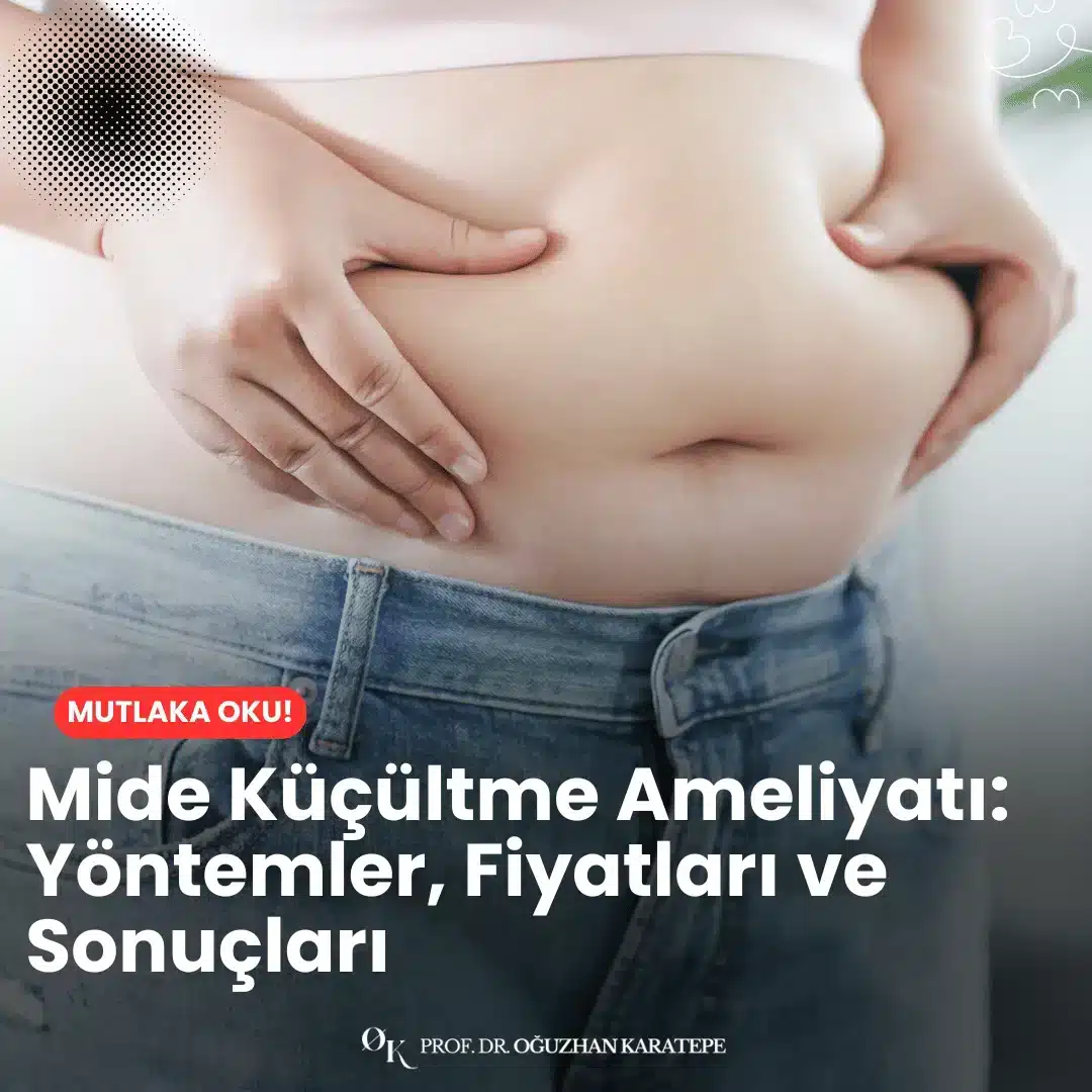 Mide küçültme ameliyatı: yöntemler, fiyatları ve sonuçları sayesinde fazla kilolardan kalıcı olarak kurtulmak mümkün. Uygulanan teknikler, fiyat aralıkları ve hasta yorumları bu yazıda.