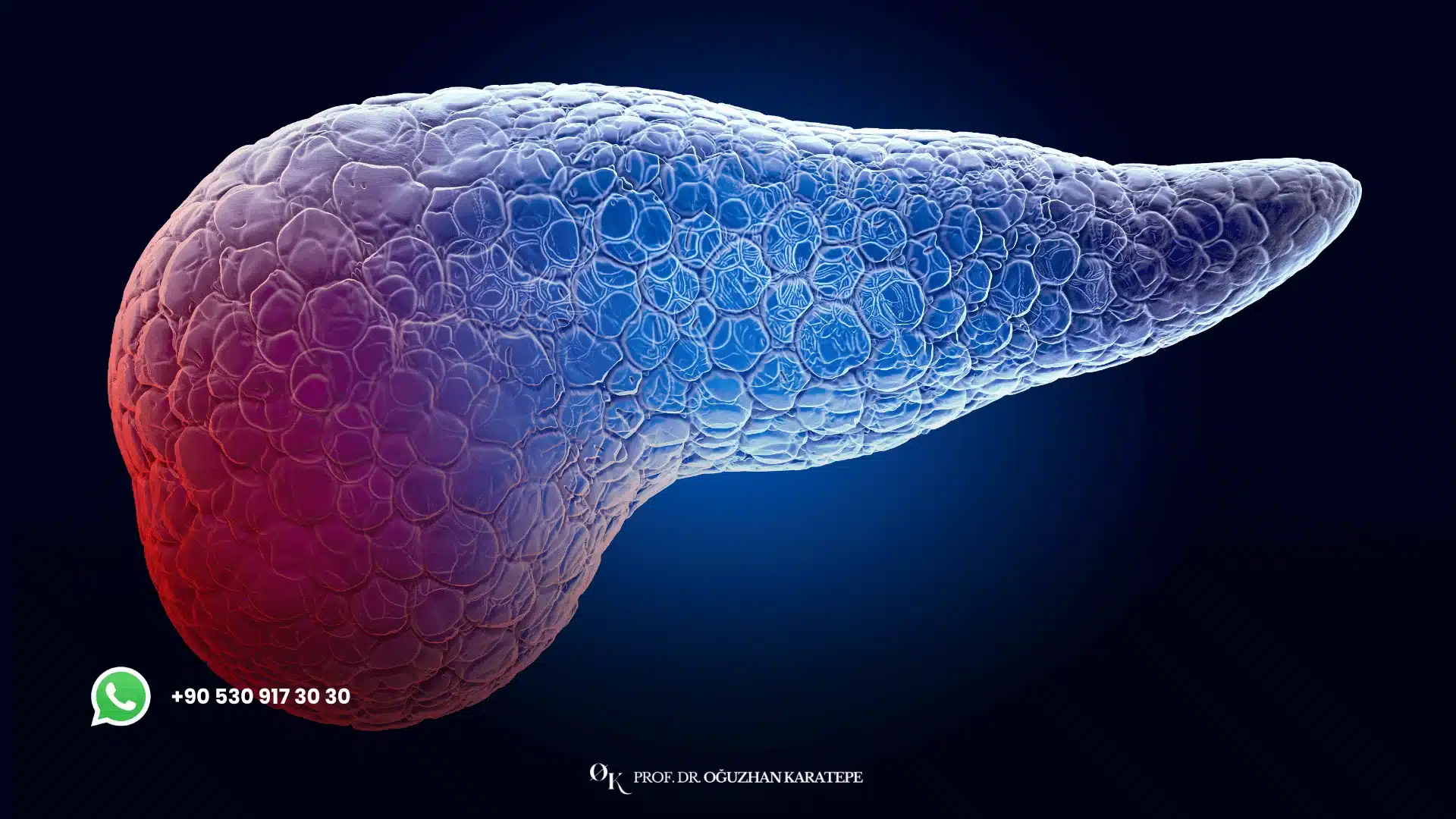 Whipple surgery recovery after pancreatic cancer diagnosis