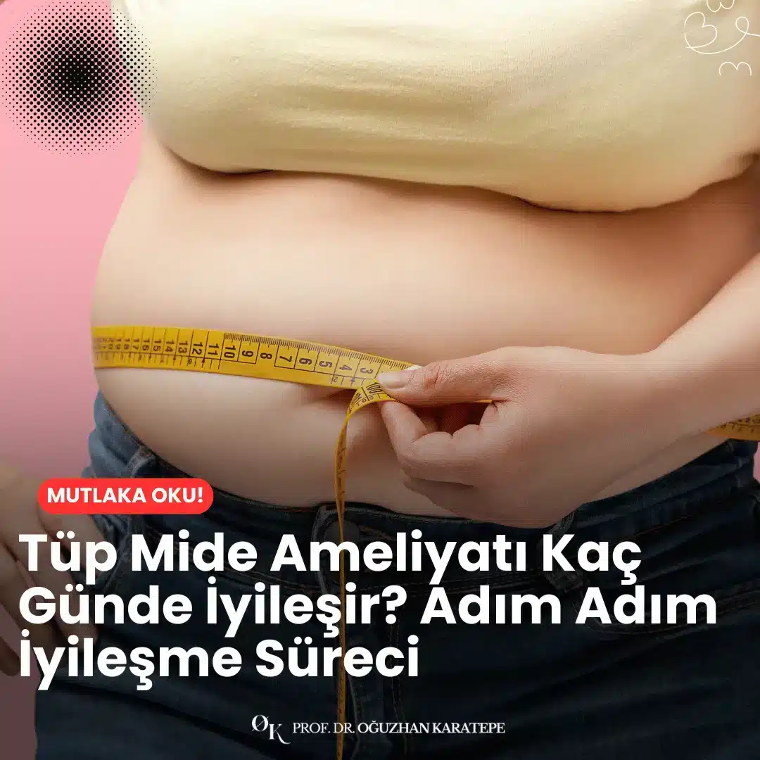 Tüp mide ameliyatı kaç günde iyileşir? Adım adım iyileşme süreci rehberimizde; 1. günden 30. güne kadar yaşanabilecek fiziksel değişimleri ve dikkat edilmesi gereken noktaları paylaşıyoruz.