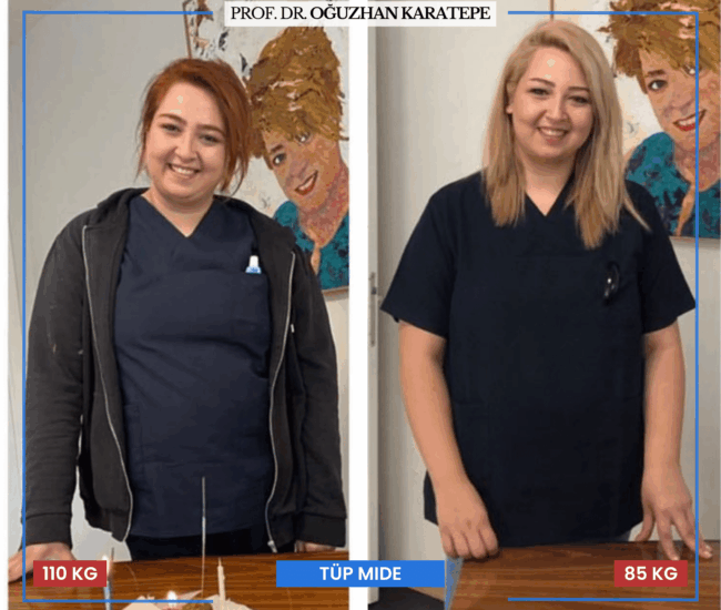Tüp Mide Ameliyatı Öncesi Sonrası Yorumlar ve Gözlemler Ameliyat öncesi sonrası tüp mide kullanıcılarının düşünceleri