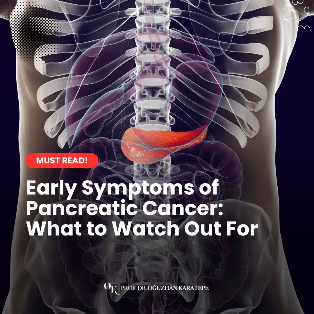 Early Symptoms of Pancreatic Cancer What to Watch Out For?